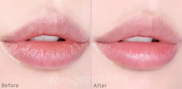 Эффект от применения корейской маски для губ