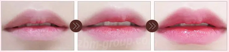 Результат применения бальзама для губ Lip Balm