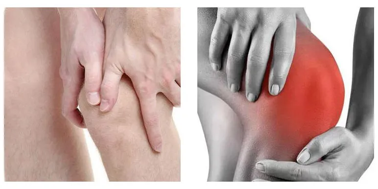 Пластырь от боли в коленном суставе от разных видов боли