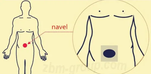 Принцип действия урологического пластыря ZB Prostatic Navel Plaster