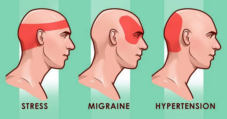 Китайский пластырь от головной боли справится с различными видами боли