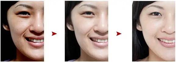 До и после применения маски для лица с гиалуроновой кислотой