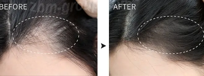 До и после применения шампуня от выпадения волос HIISEES Anti-off