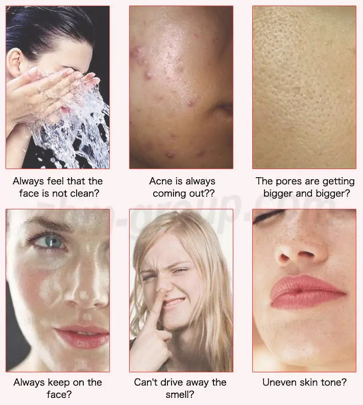 Очищение для проблемной кожи лица