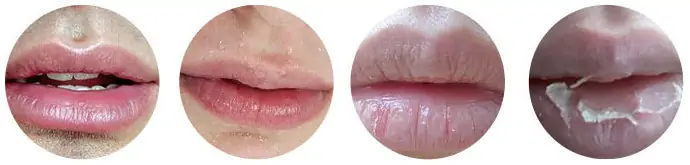 Эффект и назначение мужского бальзама для губ
